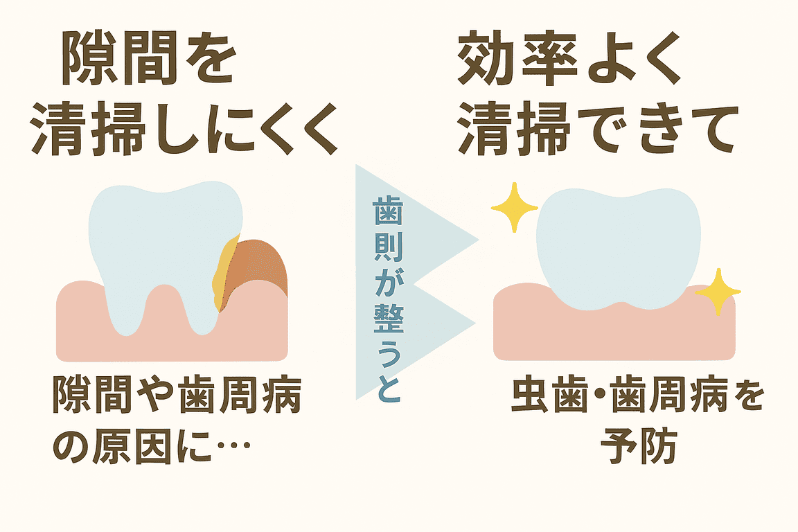 歯列が乱れている状態と整っている状態での清掃しやすさを示すイラスト