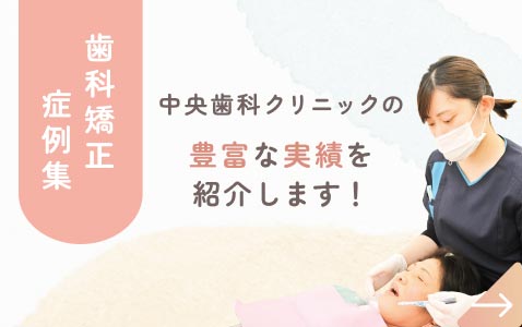 中央歯科の歯列矯正症例紹介