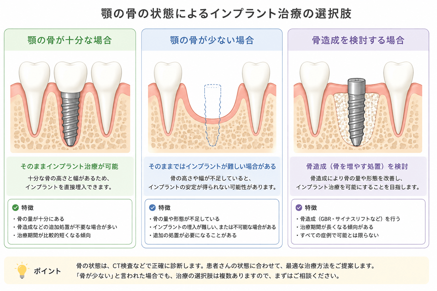 顎の骨が十分な場合と骨が少ない場合、骨造成を検討する場合の比較