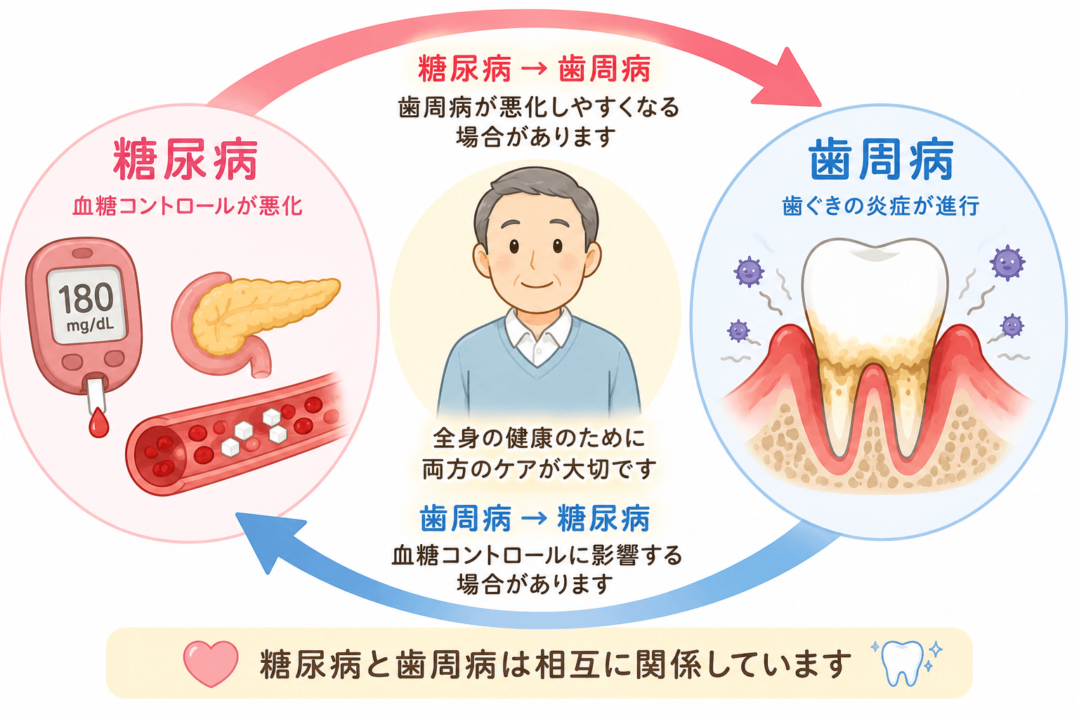 糖尿病から歯周病、歯周病から糖尿病へ互いに影響する双方向の関係を示すイラスト